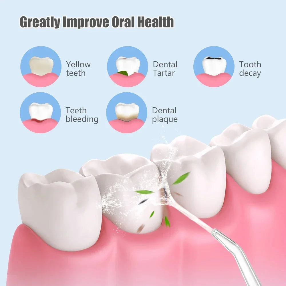 ✨ Portable Oral Irrigator  ✨